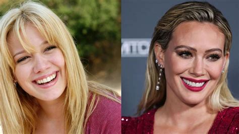 hillary duff plastic surgery|Hilary Duff’s Plastic Surgery: The How I Met Your Father Cast。